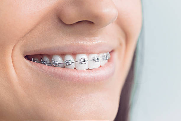 Trusted Bogalusa, LA  Holistic Dental Services Experts